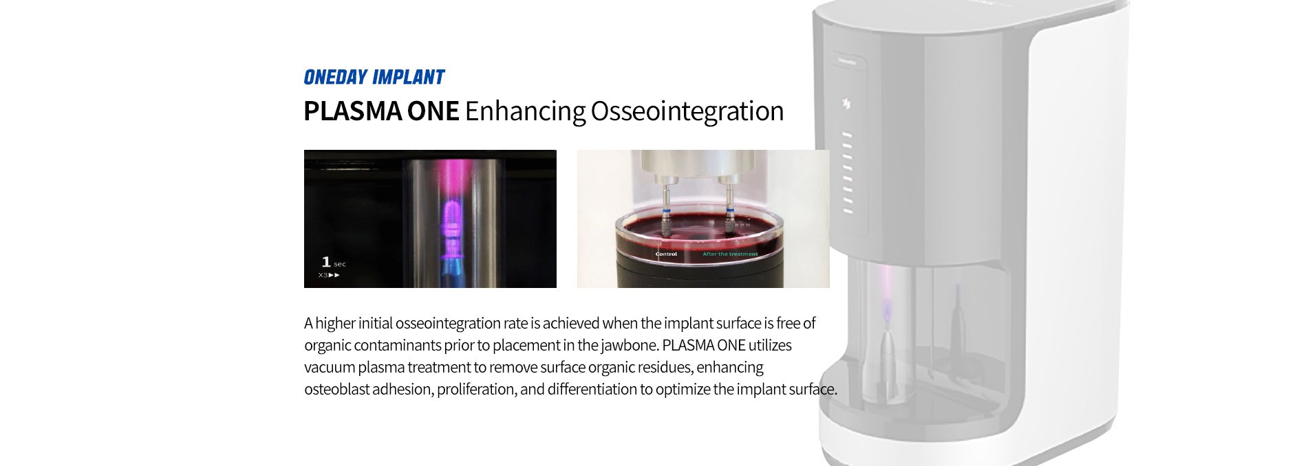 PLASMA ONE technology enhancing osseointegration by optimizing implant surface conditions before placement.
