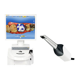 Cerec Omnicam 치과용 영상저장전송장치 이미지
